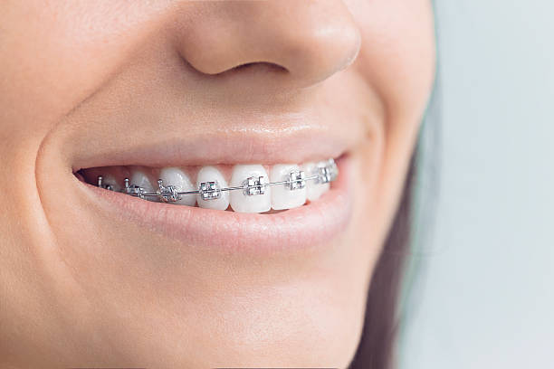 Best Sealants  in Iceville, AL